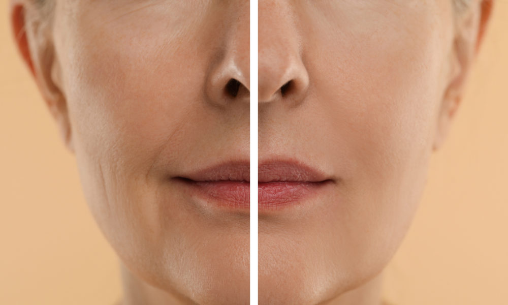 Retinol para piel seca Medipiel