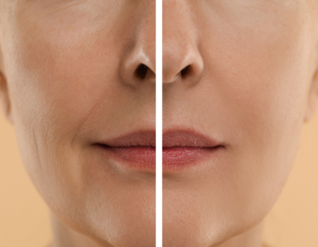Retinol para piel seca Medipiel